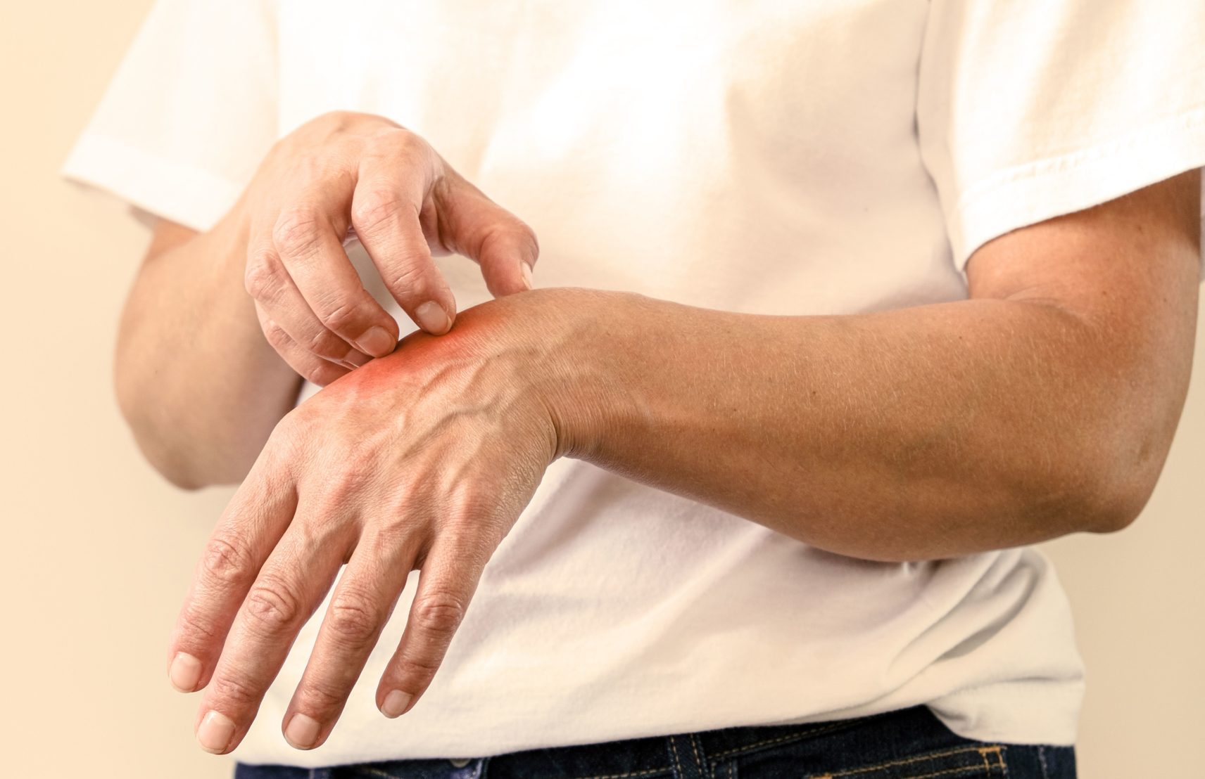 Entreprise-desinsectisation-guepes-nuisibles-chrono